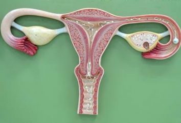 Diagnoza "endometriozy": objawy i leczenie choroby