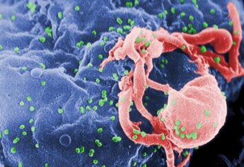 Sintomo AIDS: come la malattia si manifesta?