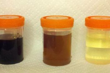 análise da urina: tipos e métodos de recolha