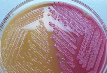 medio Ploskireva (Bacto-agar F): descrizione. microbiologia medica