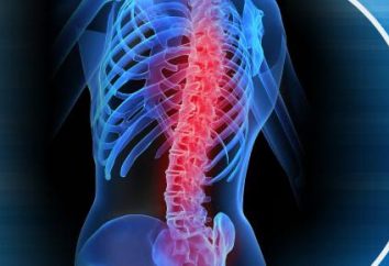 Gimnasia para la columna vertebral: Ejercicio y procedimientos