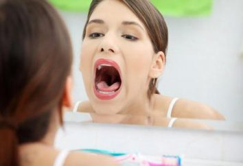 Las manchas blancas en la garganta: causas