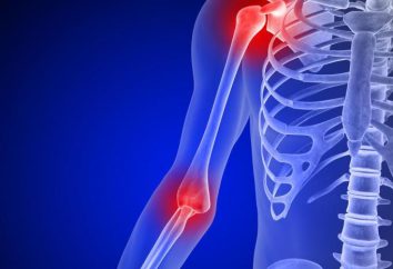 Ból ramienia w stawie barkowym: przyczyny, zapobieganie, leczenie. Ból stawu barkowego lewej i prawej strony