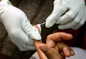 Gdzie i jak zrobić test na HIV anonimowo