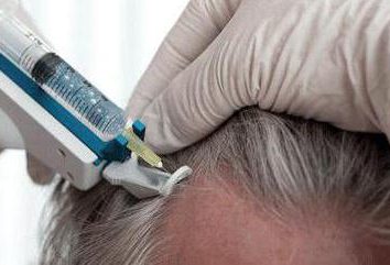 Mesoterapia del cuero cabelludo: críticas