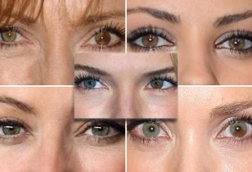 Différents yeux humains – qu'est-ce que cela signifie?