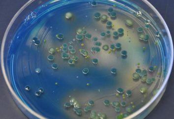 Las propiedades culturales de las bacterias: la definición, descripción, características y funciones