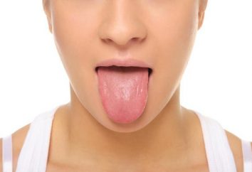 Welches ist, warum das Wachstum auf der Zunge gibt es