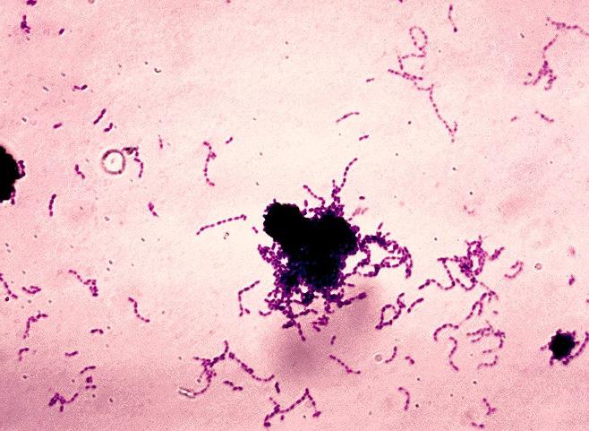 Streptococcus viridans: caratterizzazione del patogeno e infezione