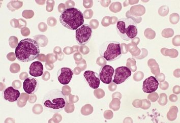 Cosa è aumentato neutrofili nel sangue?