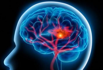 Le régime d'accident vasculaire cérébral: le menu et les recommandations des médecins