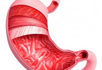 gastritis superficial: ¿qué es? Causas, síntomas y métodos de tratamiento