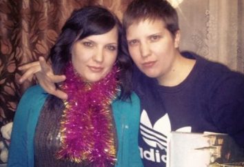 Bliźniąt syjamskich w Rosji – Anna i Tanya Korkin po 26 latach
