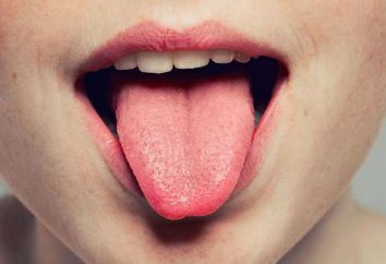 Pourquoi a imposé la langue: les causes, les symptômes des maladies, le traitement