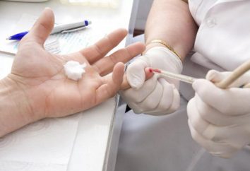 medycznych pytania: co trzeba wiedzieć o dostawie analizy i dlaczego pobrano krew z palca pierścień?