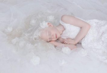 Um fotógrafo talentoso canta beleza hipnótica de pessoas albinas