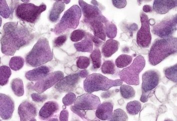 Ureaplasma spp. – Che cos'è? Sintomi, il trattamento e le conseguenze