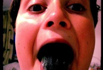 Schwarze Zunge: Ursachen, Behandlung
