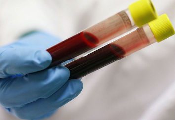 Diagnosi delle malattie. Le analisi biochimiche del sangue: quello spettacolo?