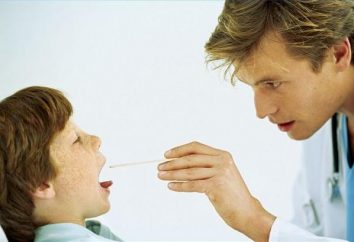 Come viene trattata la tonsillite cronica? Principi fondamentali della terapia
