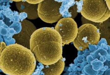 Analyse de Staphylococcus aureus: comment et où prendre un laissez-passer