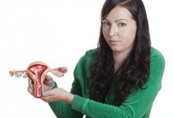 Drüsen- Endometrium Polyp: Ursachen, Symptome und Behandlung Funktionen