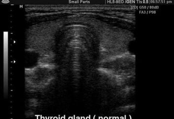 US de uma glândula tireóide – a norma. As dimensões da glândula tiróide – a norma. Indicadores de hormônios da tireóide – a norma
