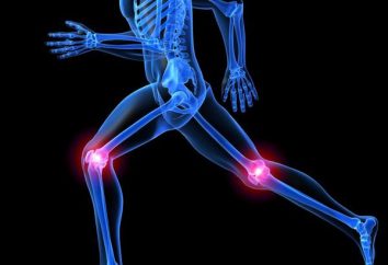A operação de substituição do joelho: comentários. artroplastia do joelho: reabilitação