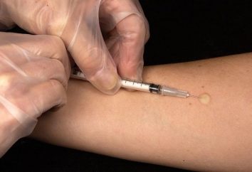 La vaccinazione Manta NORM, anomalie