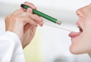 La malattia – tonsillite cronica. Trattamento di rimedi popolari