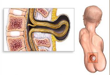 El tubo neural en el feto – que es y cómo se forma?
