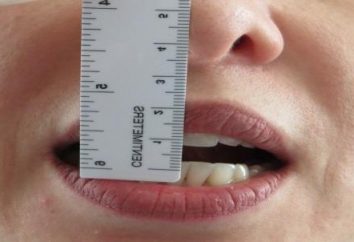 Menor mandíbula … ¿Cómo reconocer y curar su dislocación?
