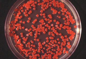 Co bakterie znaleźć sanitariuszy planety: krótką odpowiedź