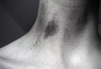 Chupetón en el cuello – erotismo en la clara