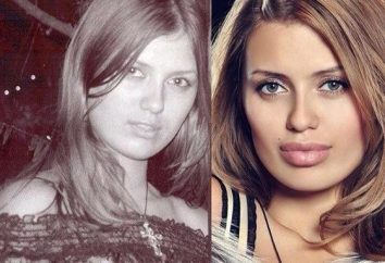 Viktoria Bonya przed i po plastikowej wargą