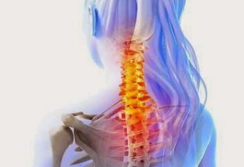 Wie man die Muskeln des Halses entspannt: Wege, um Spannungen, Übungen und Empfehlungen von Spezialisten zu entlasten