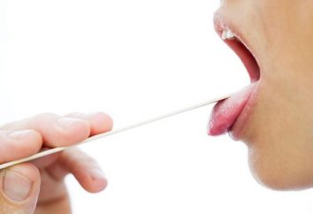 Los primeros signos de cáncer de garganta: cómo distinguir el cáncer del frío