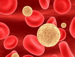 linfocitos de sangre elevados en los niños: Lo que usted necesita saber