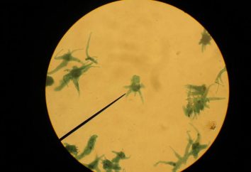 Amoeba Proteus: classe, habitat, fotos. Como a ameba se move contra ele?