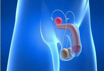 El cáncer de próstata es el segundo grado: revisión del tratamiento. Los síntomas del cáncer de próstata en los hombres. la esperanza de vida de previsión
