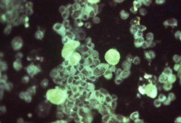 Cytomégalovirus: ce qu'il est et comment cette maladie dangereuse?