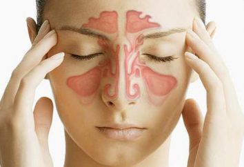 Wirksame Heilmittel für Sinusitis: ein Vergleich der besten Vorbereitungen und Bewertungen über sie