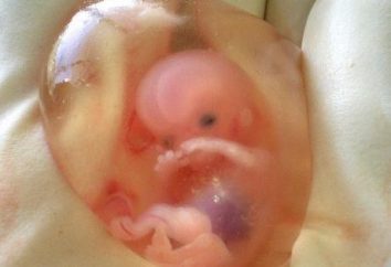 los niños abortados: asesinato o una necesidad?