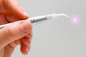 trattamento dentale laser senza dolore e l'angoscia