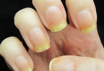 Comment blanchir les ongles à la maison? Grands moyens. Pas cher et vérifié.