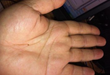 Significado de los lunares en la palma de la mano: se dice que la quiromancia?