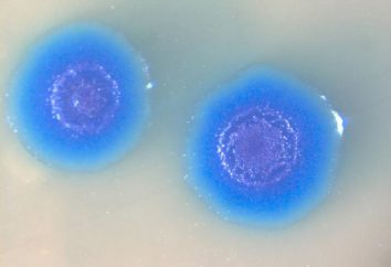 Mycoplasma genitalium: co to jest? Jak niebezpieczne zakażenie?