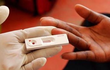 HIV-Test: hinsichtlich der Bereitschaft, wo und wann nehmen