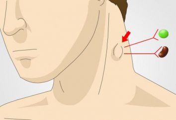 Ganglios linfáticos inflamados en el cuello: las posibles causas, los síntomas y características de tratamiento