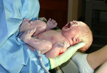 Sangrado en el cerebro del recién nacido: causas y consecuencias